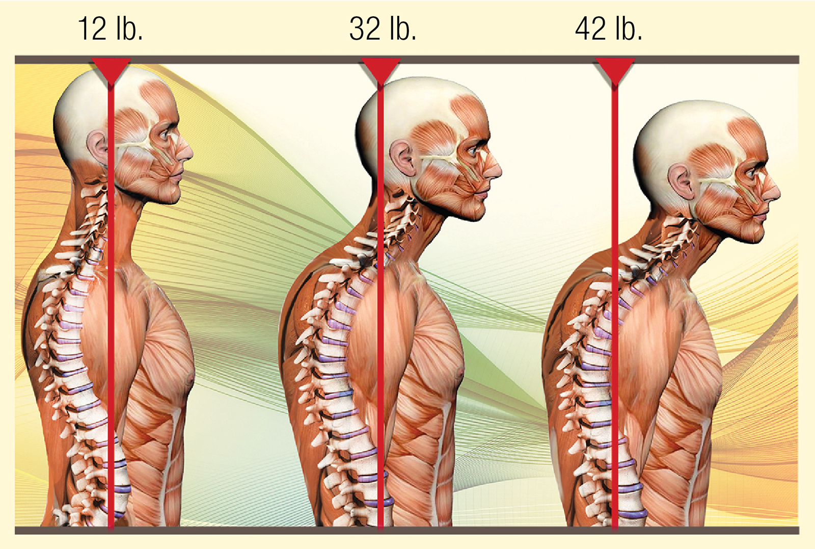 MA_15_Myoskeletal1_Main_1600