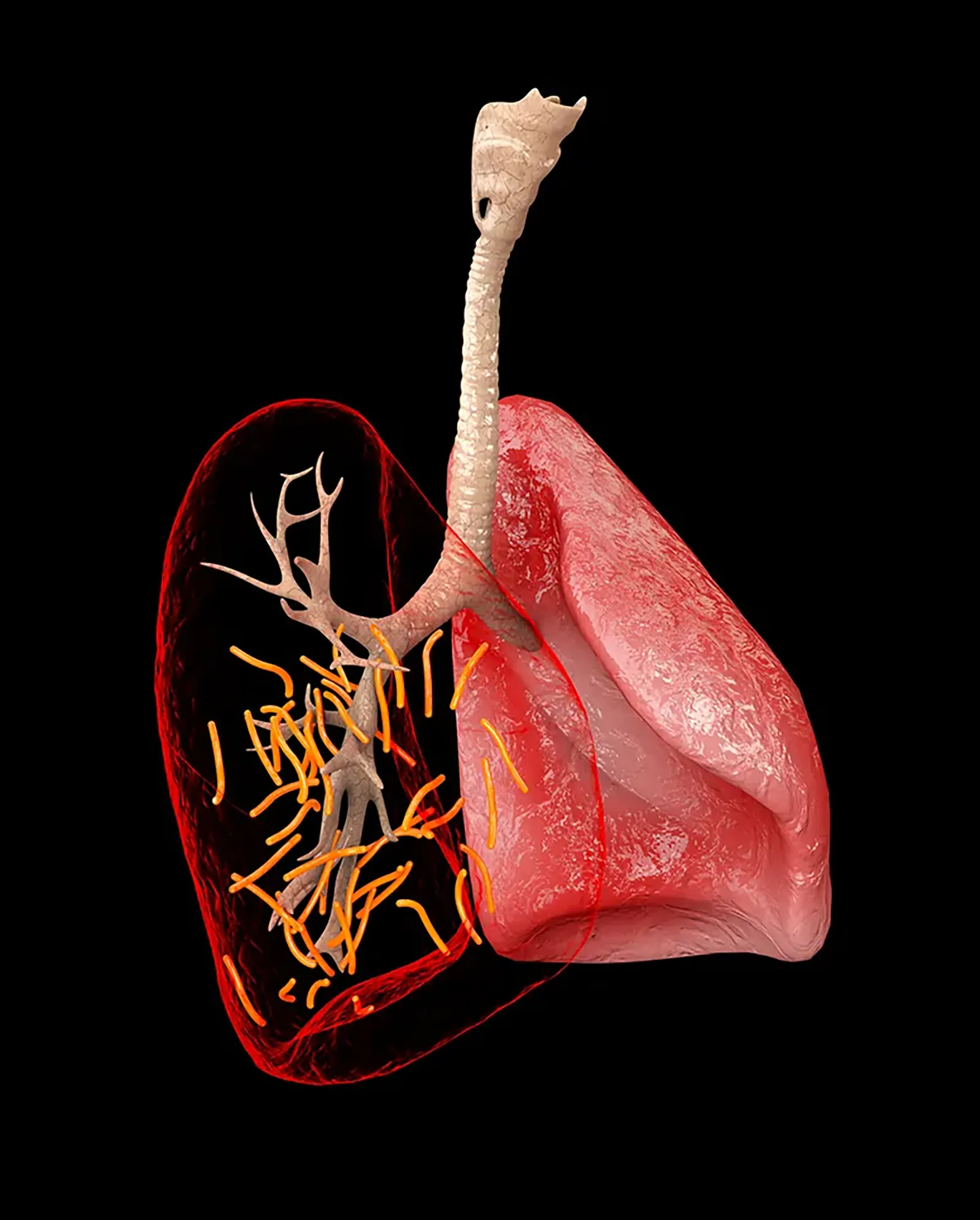 MJ21_PulmonaryFibrosis_Main MJ21_PulmonaryFibrosis_Main