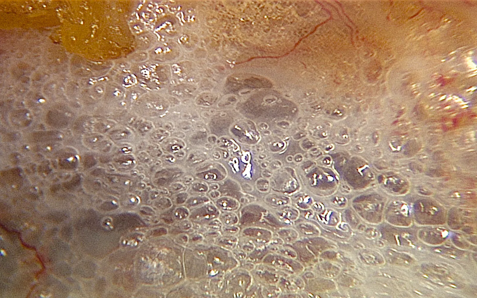 SO_16_LivingFascia8_Guimberteau_1600