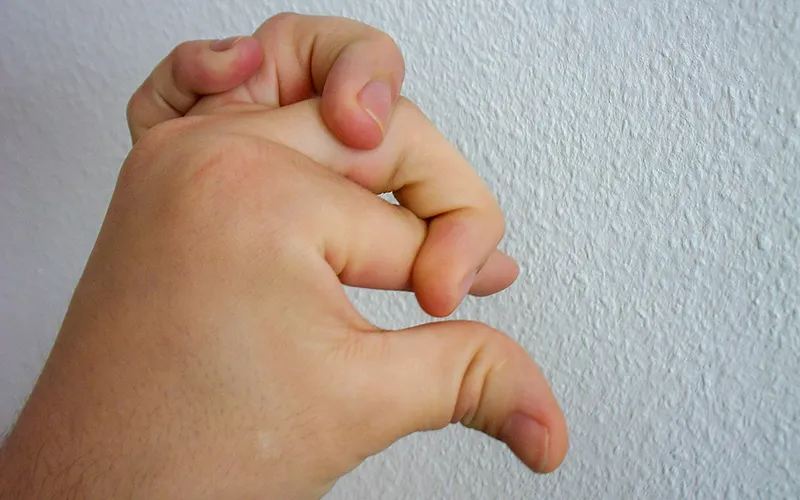 ND19_Ehlers-Danlos Syndrome2