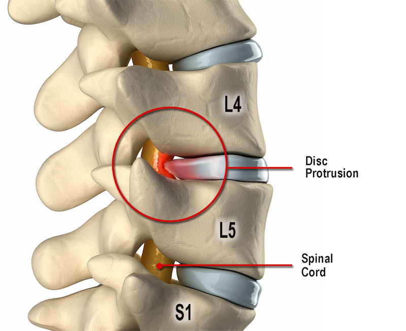 ND16_Myoskeletal3