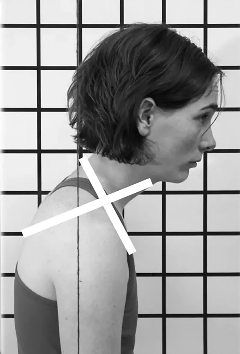 ND20_Managing Upper Back5 ND20_Managing Upper Back5