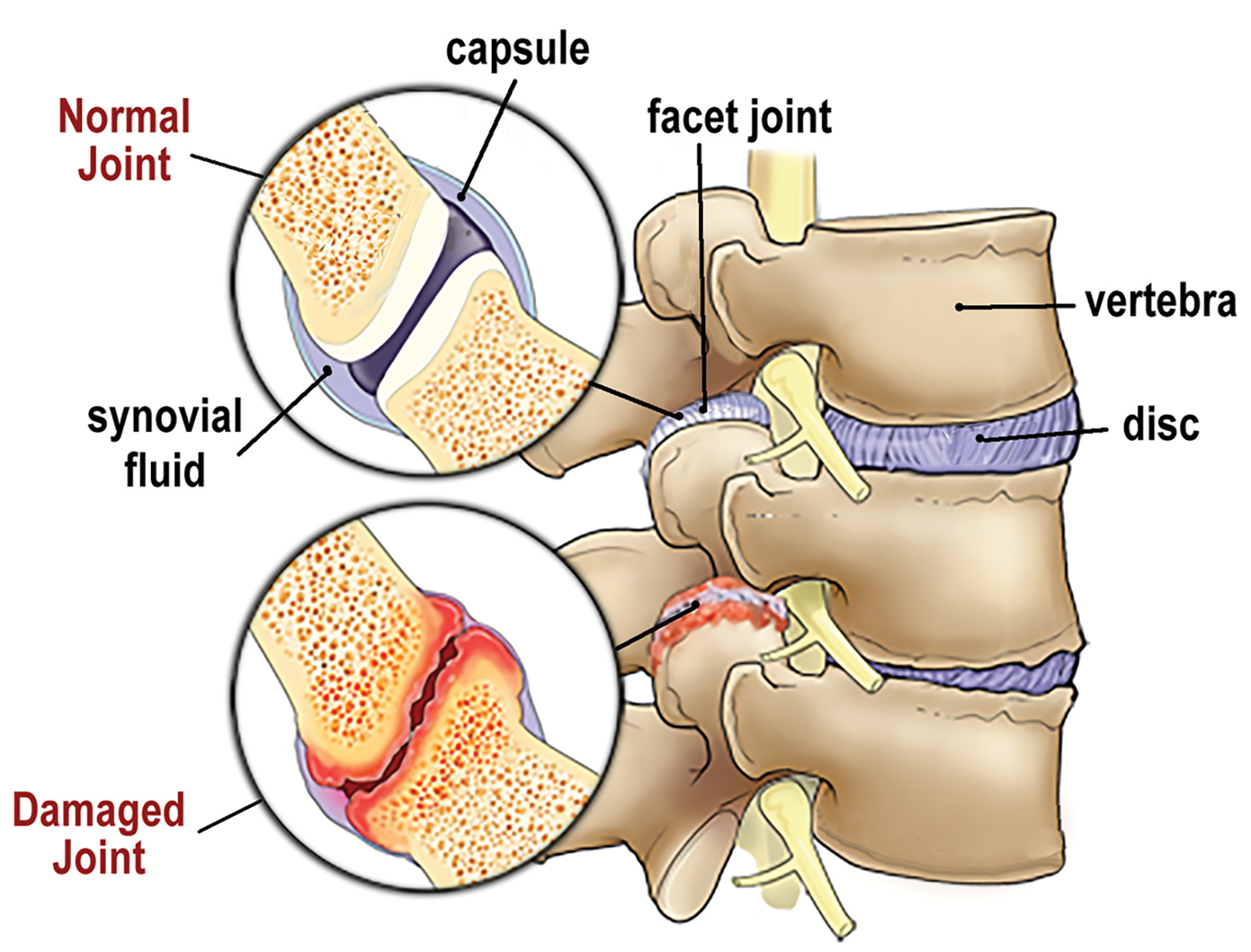 MA20_Myoskeletal Main MA20_Myoskeletal Main