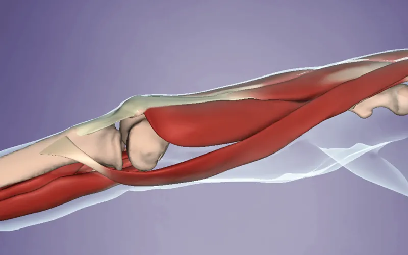 SO_18_SomaticEdge3 SO_18_SomaticEdge3