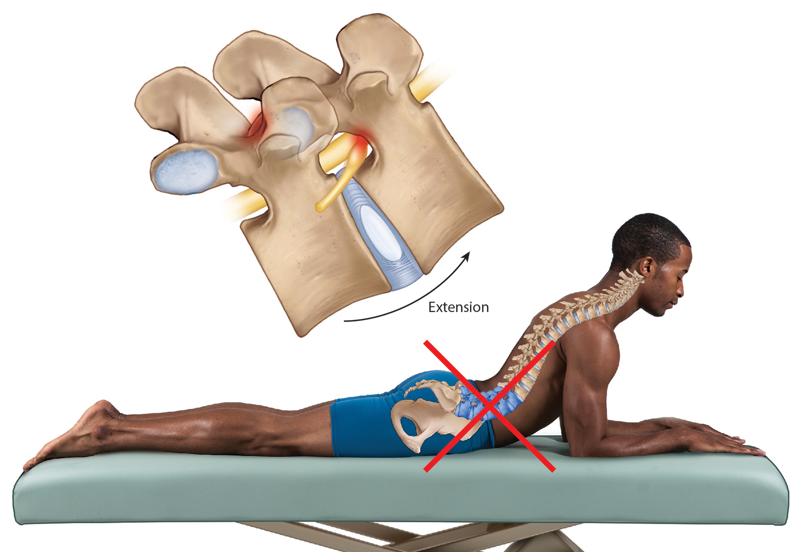 JA_16_ThoracicSpine6_1600 JA_16_ThoracicSpine6_1600
