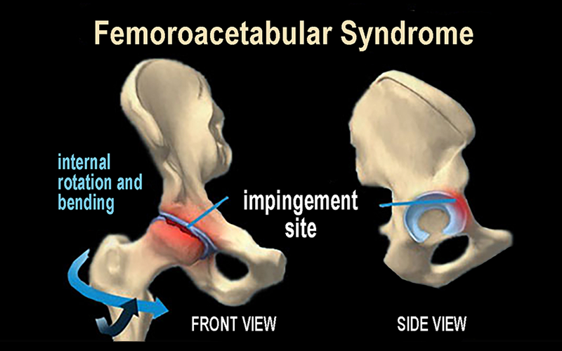 MJ_19_Myoskeletal2_800