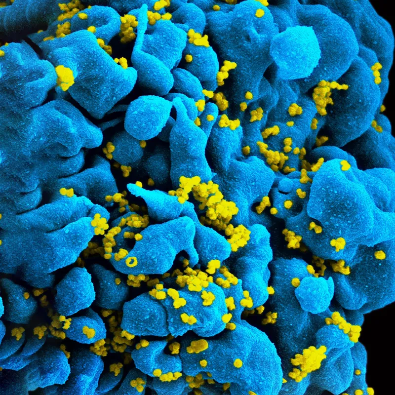 HIV AIDS Truths2