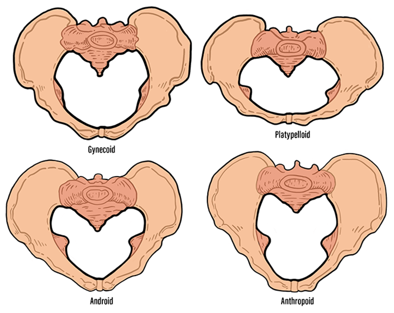 JF21_ResolvingWounds_Pelvis1 JF21_ResolvingWounds_Pelvis1