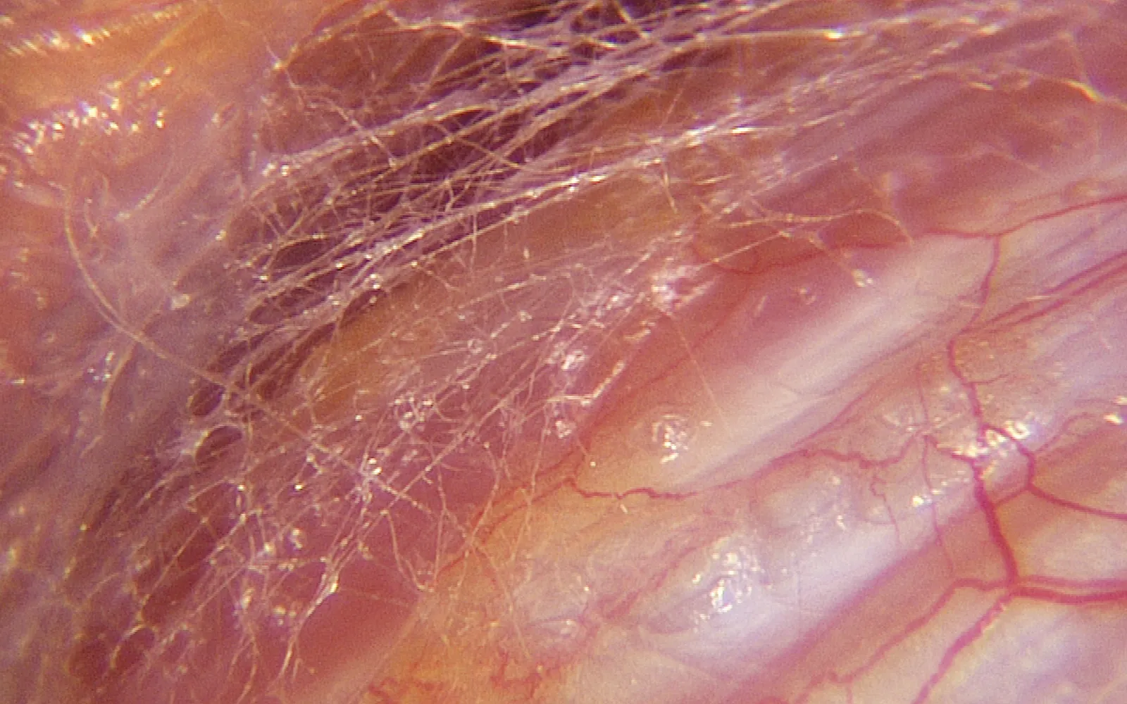SO_16_LivingFascia1_Guimberteau_1600