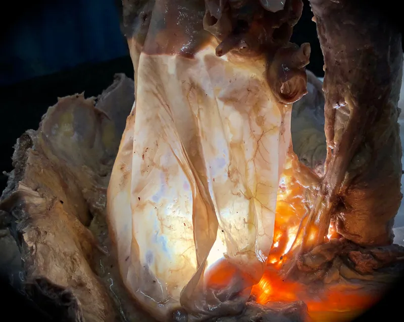SO_18_HumanFascialPlastinationProject6_Pericardium_800 SO_18_HumanFascialPlastinationProject6_Pericardium_800
