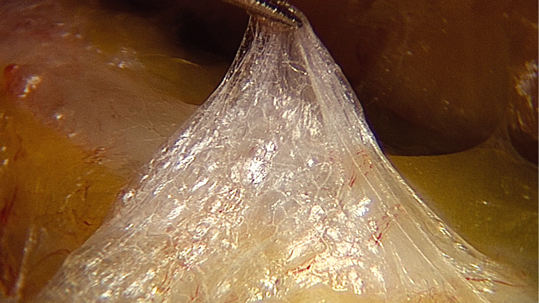 SO_16_LivingFascia9_Guimberteau_1600