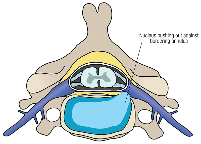 JF20_Lumbar Spine4 JF20_Lumbar Spine4