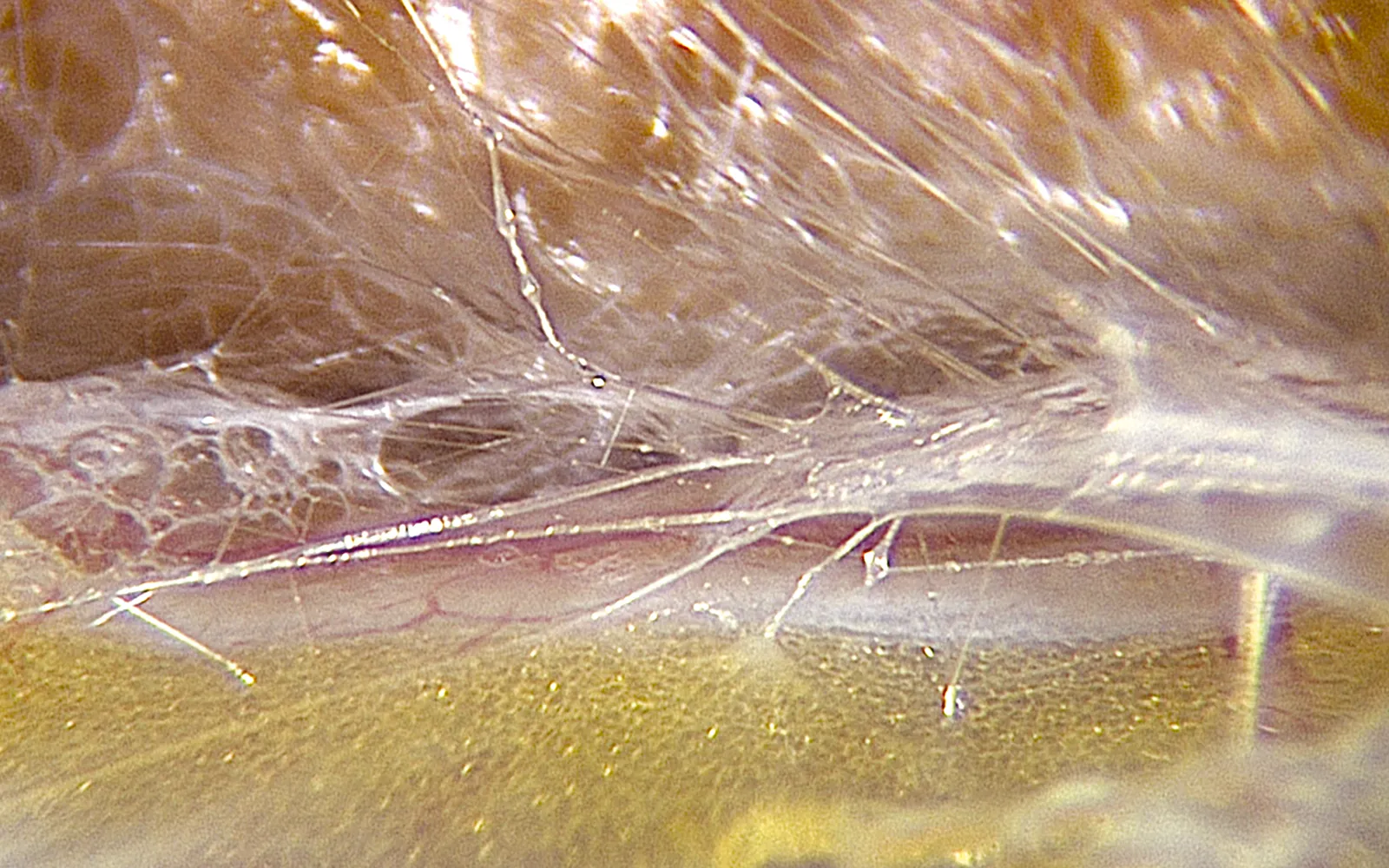 SO_16_LivingFascia6_Guimberteau_1600