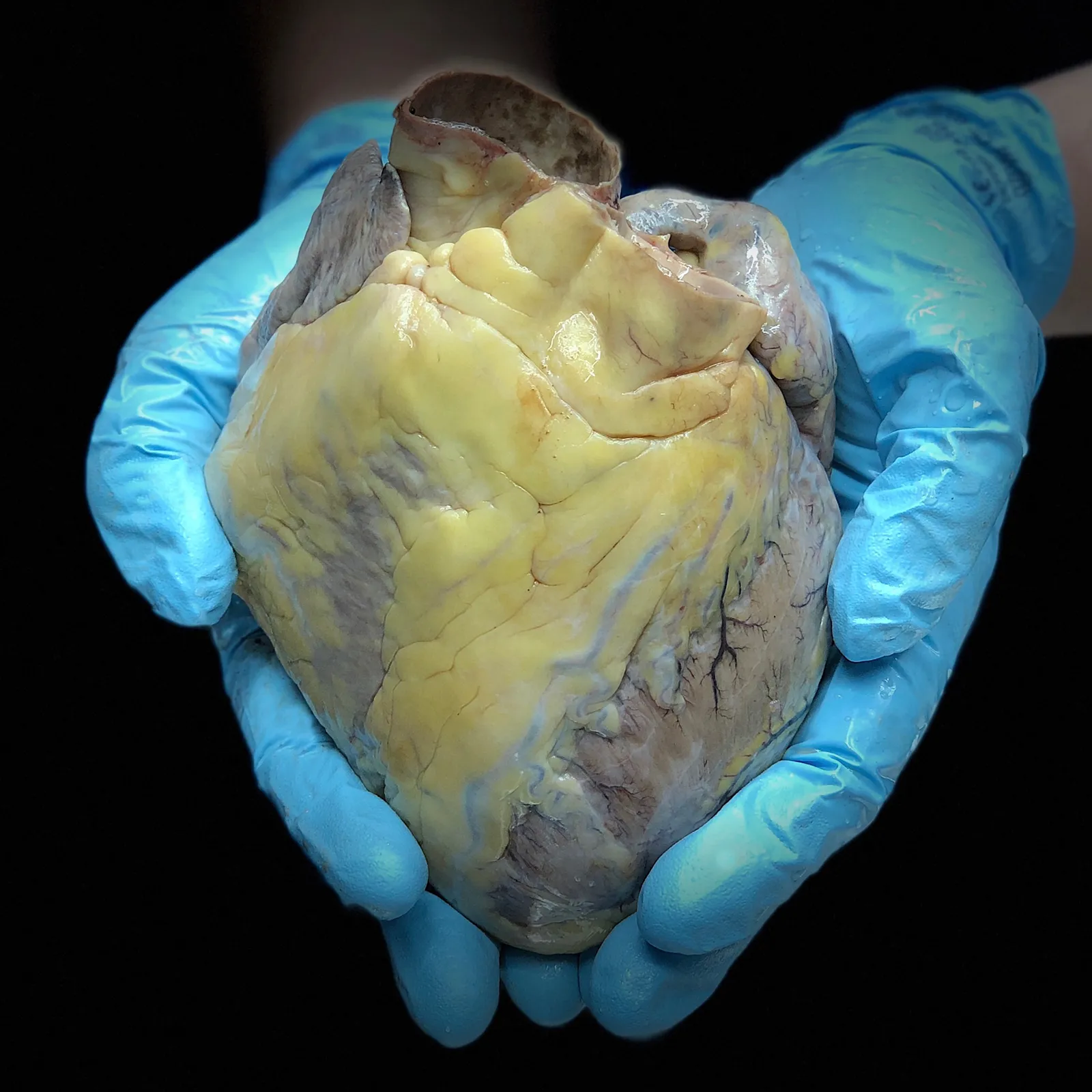 SO_18_HumanFascialPlastinationProject1_1600 SO_18_HumanFascialPlastinationProject1_1600