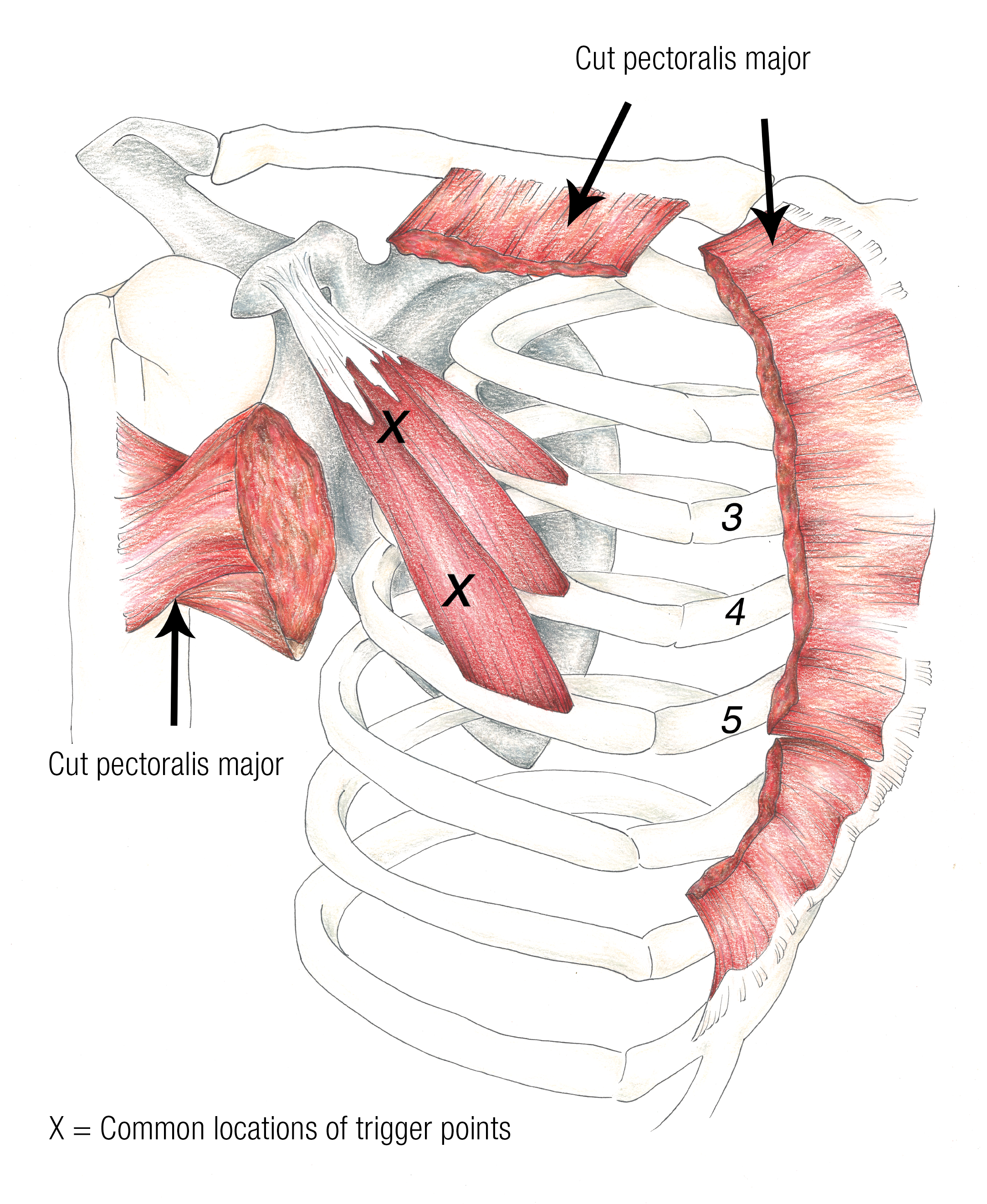 SO_16_PecMinor_TriggerPoints_1600 SO_16_PecMinor_TriggerPoints_1600