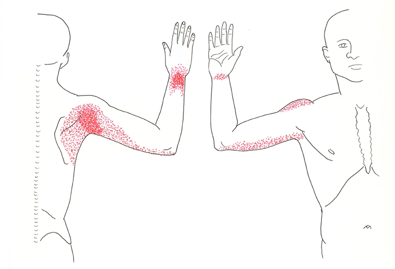 JF20_Slippery Subscap2 JF20_Slippery Subscap2