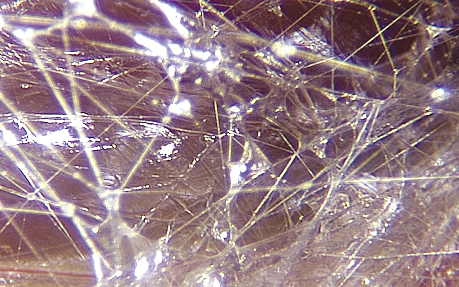 SO_16_LivingFascia4_Guimberteau_1600