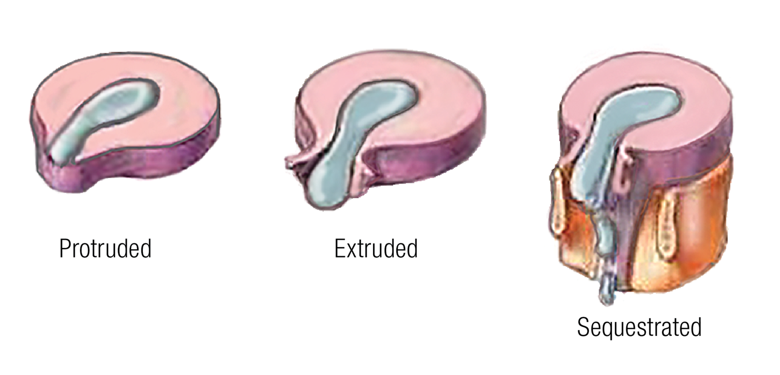 ND16_Myoskeletal2