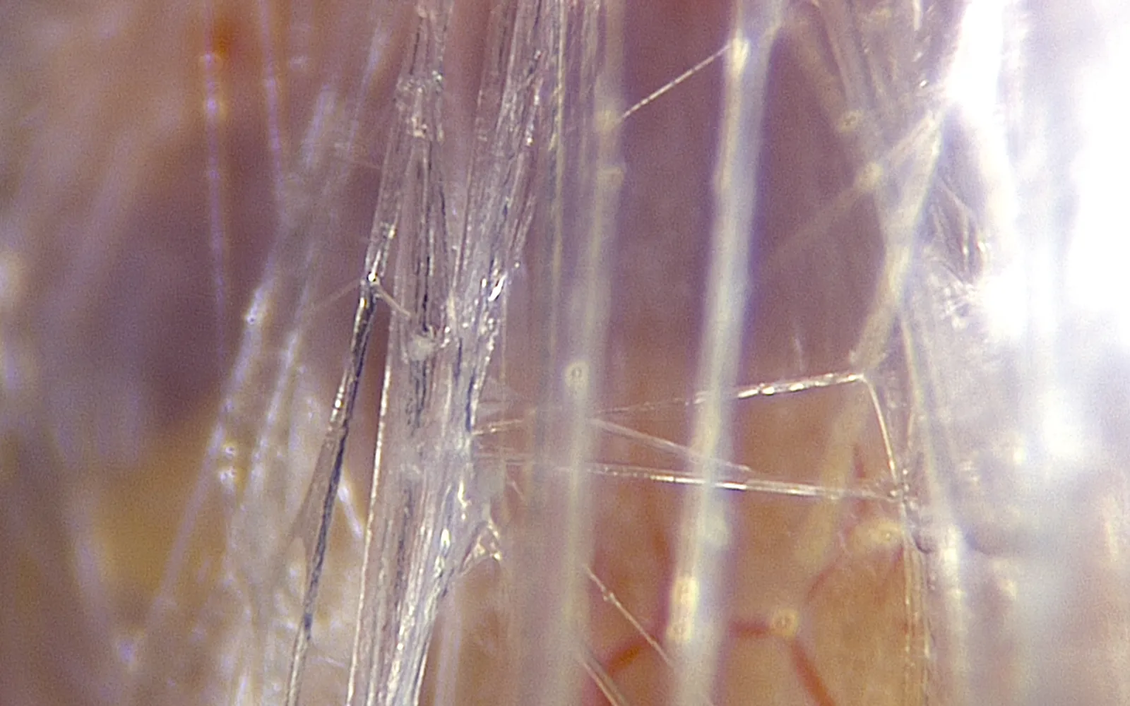 SO_16_LivingFascia3D_Guimberteau_1600
