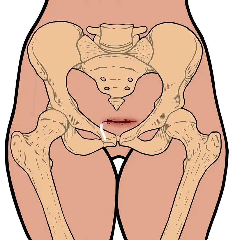 JF21_ResolvingWounds5 JF21_ResolvingWounds5