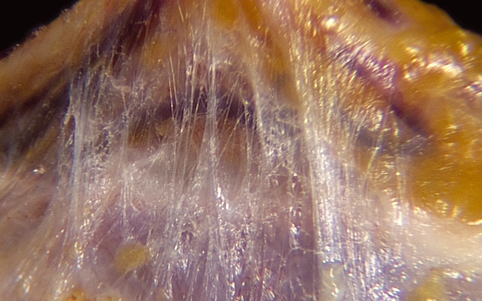 SO_16_LivingFascia3B_Guimberteau_1600