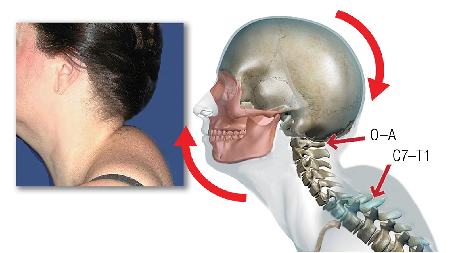 MA_15_Myoskeletal3_1600