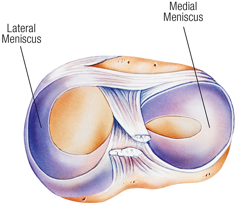 ND19_ Meniscus Tears labeled